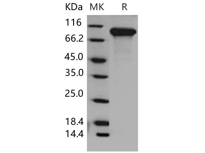 Recombinant Mouse DDR2 Kinase/CD167b Protein (His Tag) - image 1