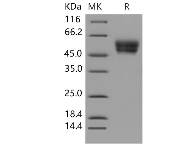 Recombinant Mouse CADM4/IGSF4C/TSLL2 Protein (His Tag) - image 1