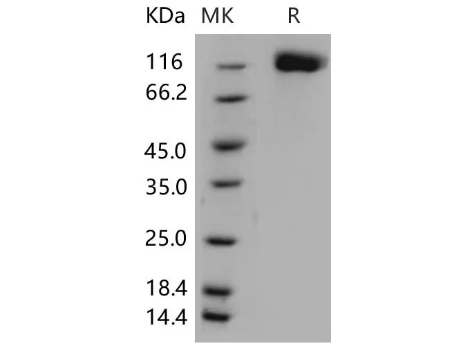 Recombinant Mouse OSMR/IL-31RB Protein (His Tag) - image 1