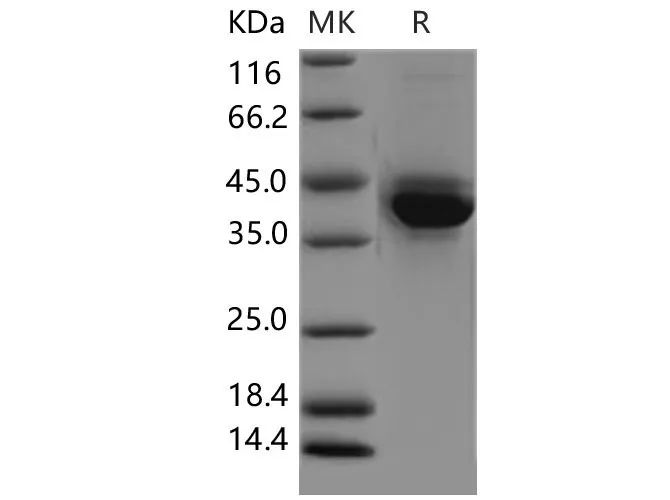 Recombinant Mouse S100A4 Protein (Fc Tag) - image 1