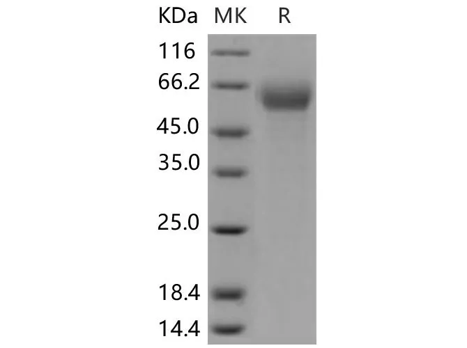 Recombinant Mouse IFNAR1/IFNAR Protein (His Tag) - image 1