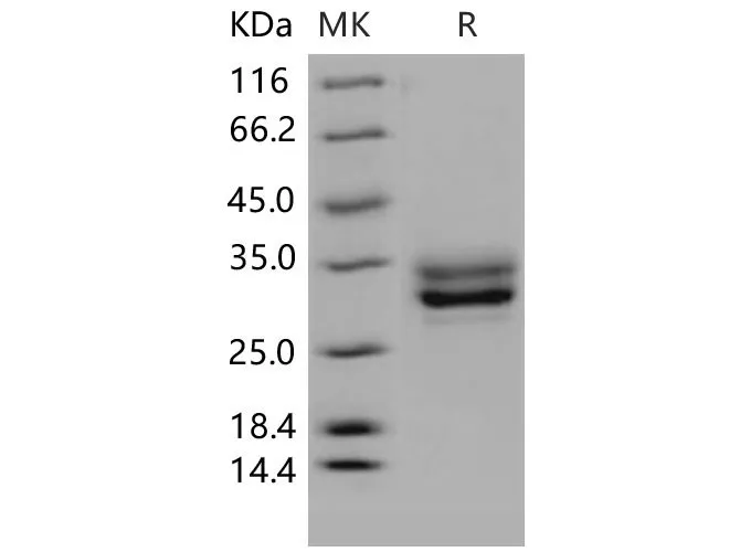 Recombinant Mouse JAM3/JAM-C Protein (His Tag) - image 1