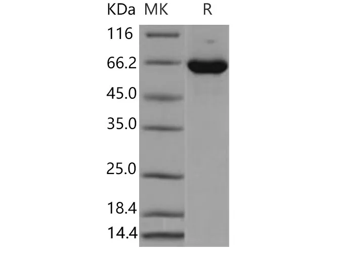 Recombinant Mouse ERK2/MAPK1/MAPK2 Protein (His & GST Tag) - image 1
