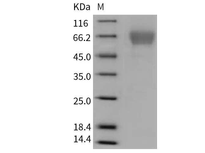 Recombinant Mouse TIM4/TIMD4 Protein (His Tag) - image 1