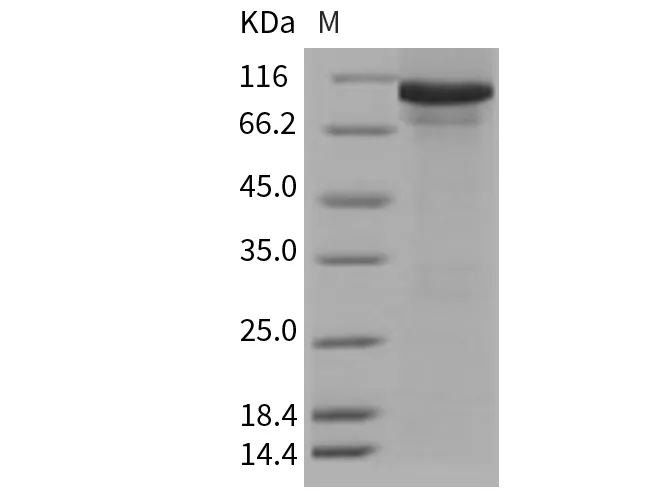 Recombinant Mouse AARS/alanyl-tRNA synthetase Protein (His Tag) - image 1