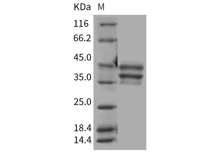 Recombinant Mouse BAFFR/TNFRSF13C/CD268 Protein (Fc Tag) - image 1