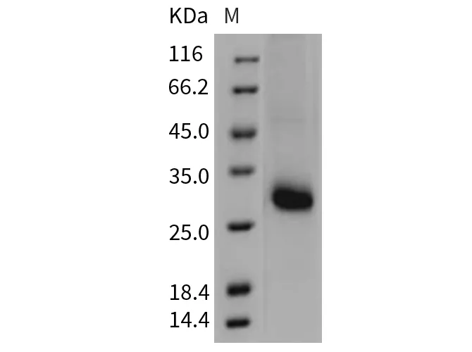 Recombinant Mouse TIMP1/TIMP Protein - image 1
