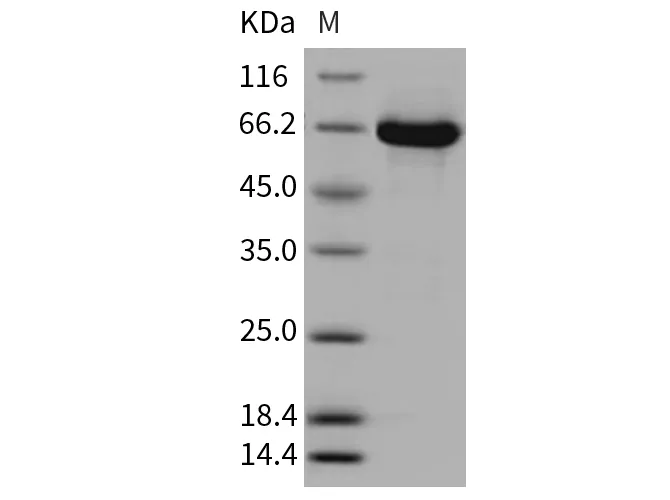 Recombinant Mouse MEK1/MAP2K1/MKK1 Protein (His & GST Tag) - image 1