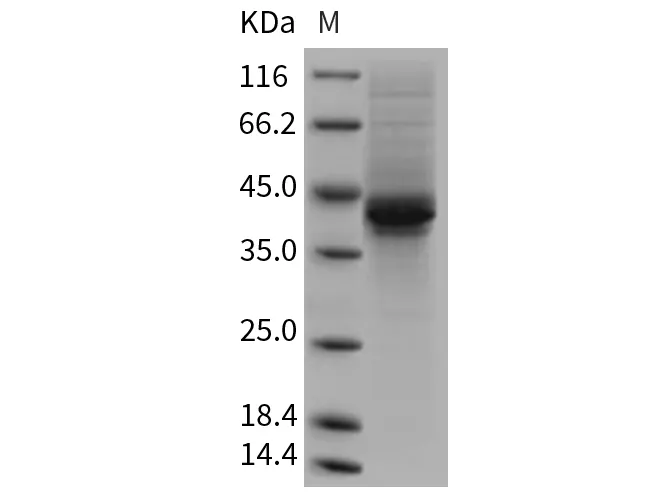 Recombinant Mouse AgRP/AGRP Protein (Fc Tag) - image 1