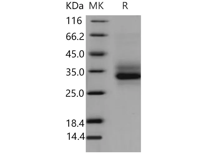 Recombinant Mouse Dectin-1/CLEC7A Protein (His Tag) - image 1
