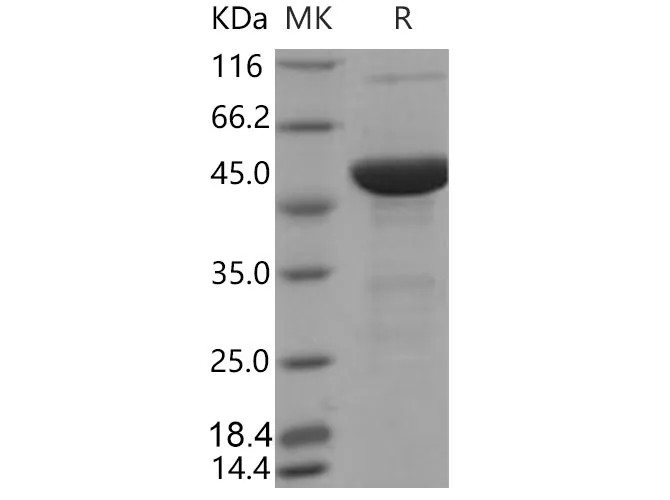 Recombinant Mouse S100A15/S100A7A Protein (His & MBP Tag) - image 1