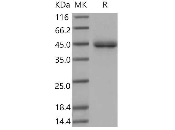 Recombinant Mouse SFTPD/SP-D Protein (His Tag) - image 1