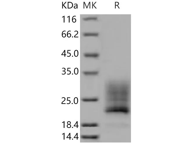 Recombinant Mouse REG4/RELP Protein (His Tag) - image 1