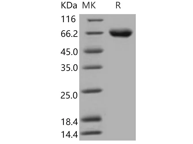 Recombinant Mouse KIRREL1/NEPH1 Protein (His Tag) - image 1