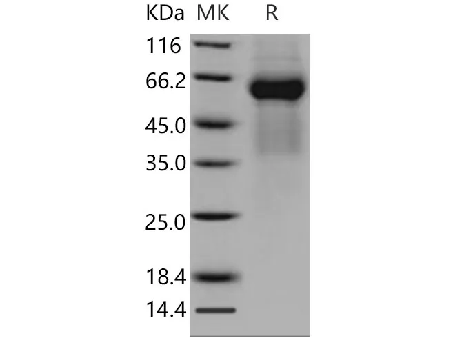 Recombinant Mouse FGFRL1/FGFR5 Protein (His Tag) - image 1