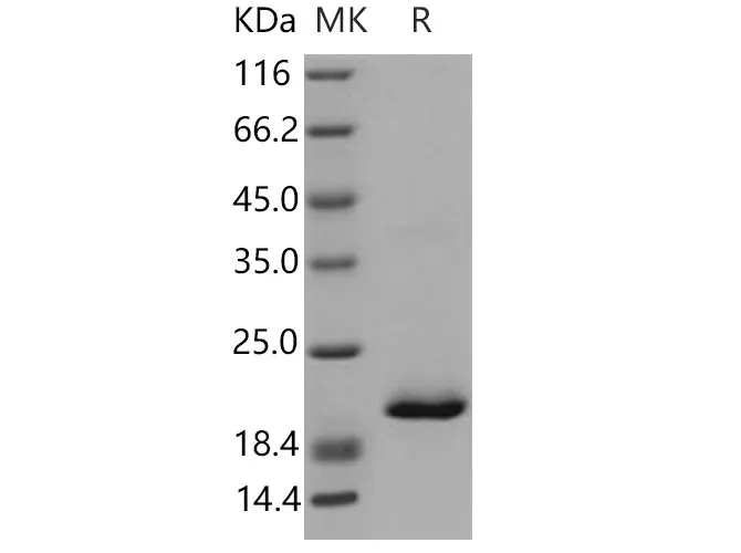 Recombinant Mouse RBP4 Protein (His Tag) - image 1