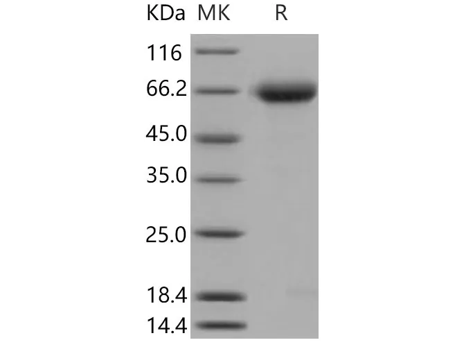 Recombinant Mouse Nogo Receptor/NgR Protein (His Tag) - image 1
