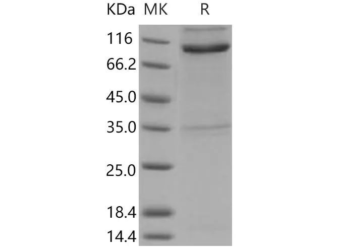 Recombinant Mouse Nogo Receptor/NgR Protein (His & Fc Tag) - image 1