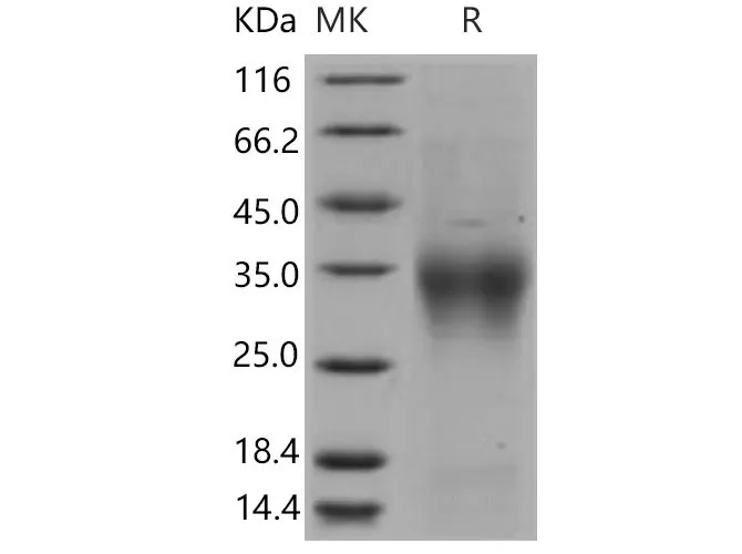 Recombinant Mouse CD28/TP44 Protein (His Tag) - image 1