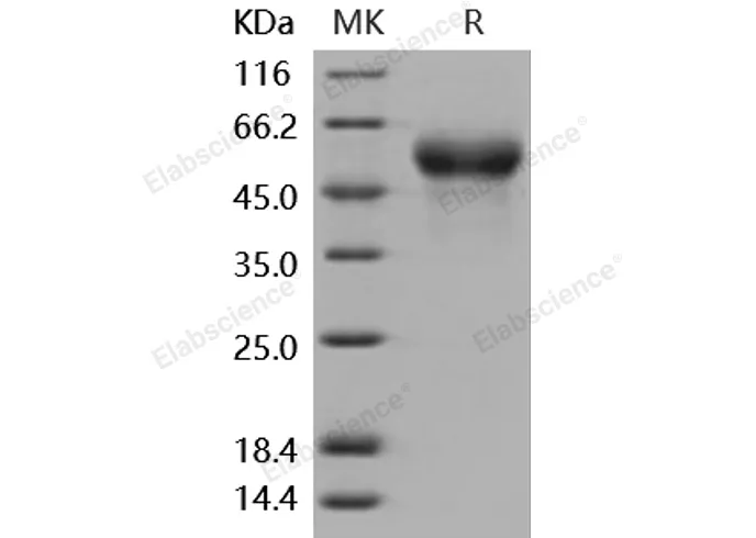 Recombinant Mouse Fetuin-A/AHSG Protein (His Tag) - image 1