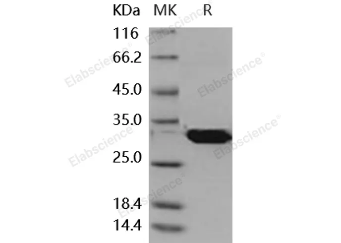 Recombinant Mouse Latexin/LXN Protein (His Tag) - image 1