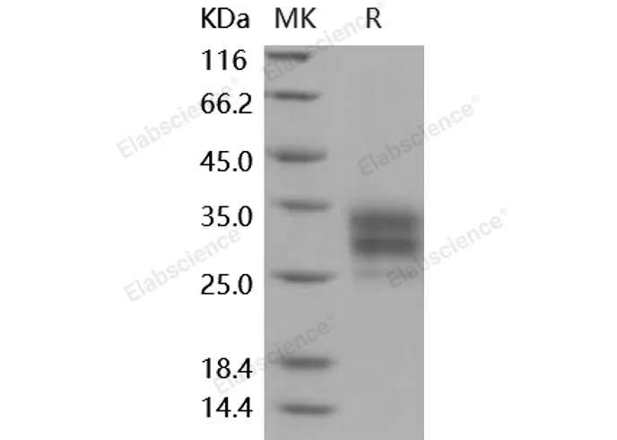 Recombinant Mouse CD16-2/FCGR4 Protein (His Tag) - image 1