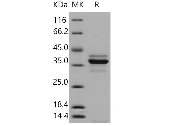 Recombinant Mouse Cathepsin L/CTSL Protein (aa 1-334, His Tag) - image 1