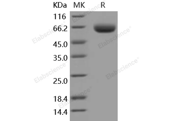 Recombinant Mouse BACE1/ASP2 Protein (His Tag) - image 1