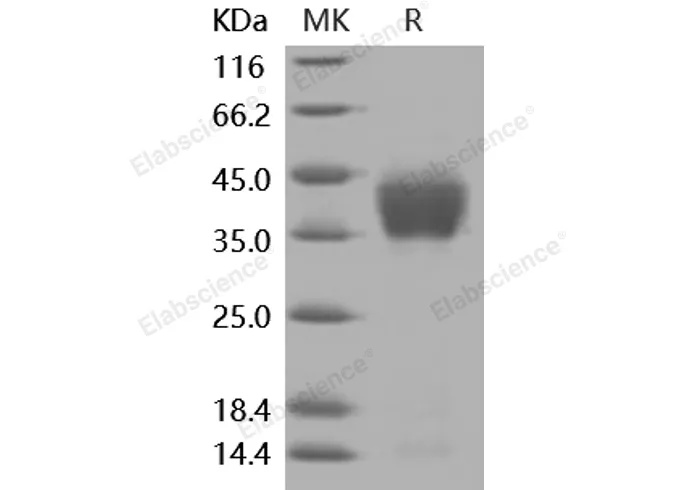 Recombinant Mouse ASGPR1/ASGR1 Protein (His Tag) - image 1