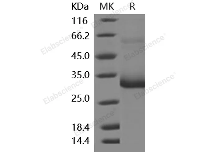 Recombinant Mouse MBL2/MBL/COLEC1 Protein (His Tag) - image 1