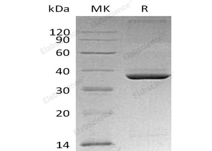 Recombinant Mouse Apolipoprotein E/ApoE Protein (His Tag) - image 1