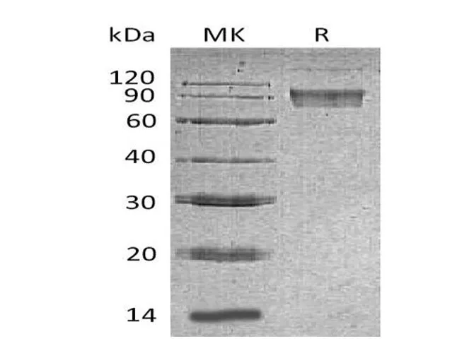 Recombinant Mouse B7-H4/VTCN1 Protein (Fc Tag) - image 1