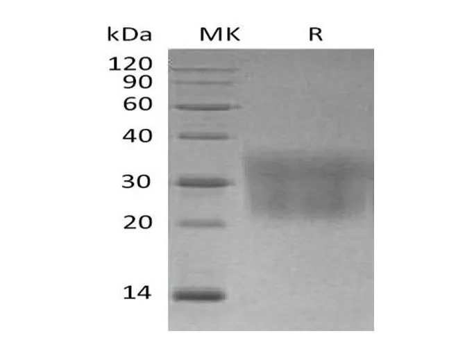 Recombinant Mouse CCL2/MCP-1 Protein (His Tag) - image 1