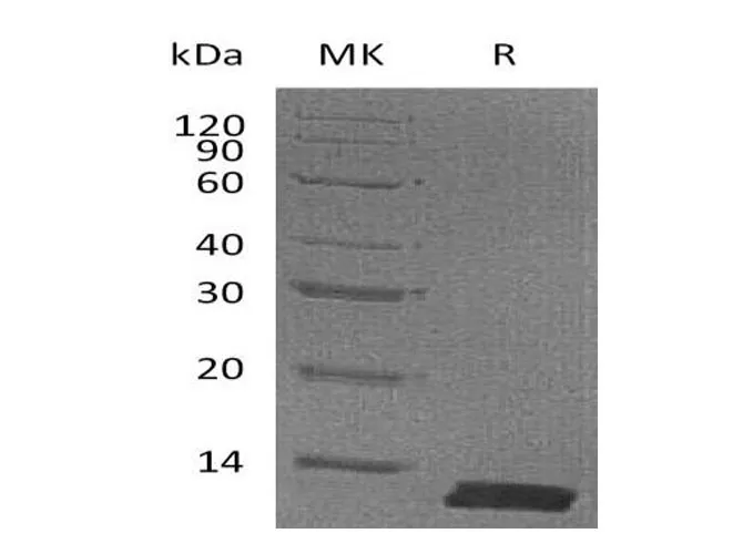 Recombinant Mouse CCL8/MCP-2 Protein (His Tag) - image 1