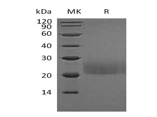 Recombinant Mouse CTLA4 Protein (Flag Tag) - image 1
