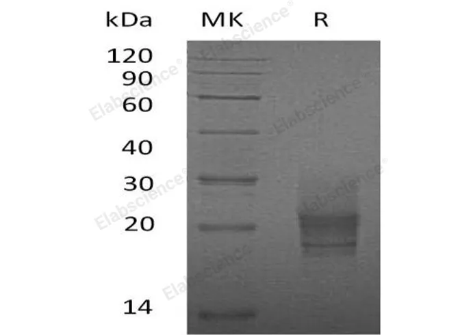 Recombinant Mouse GM-CSF/CSF2 Protein (His Tag) - image 1