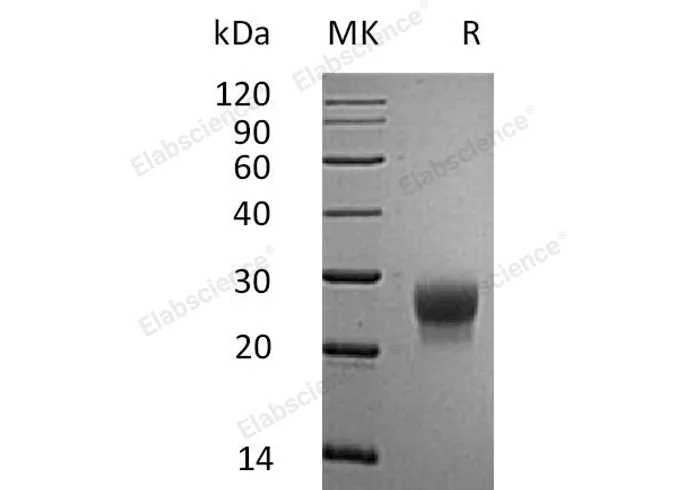 Recombinant Mouse G-CSF/CSF3 Protein (His Tag) - image 1