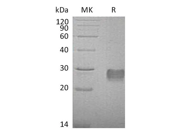 Recombinant Mouse IGFBP6/IGFBP-6 Protein (His Tag) - image 1