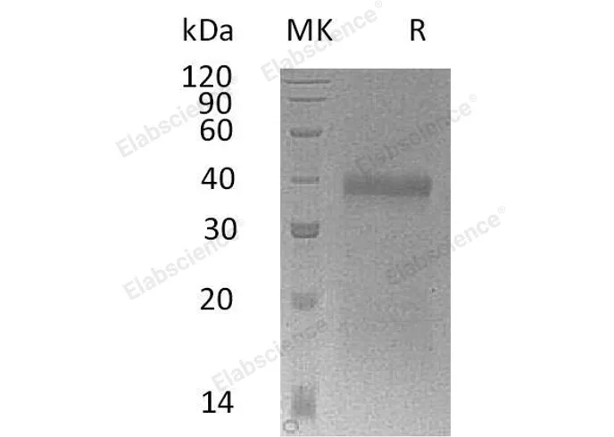 Recombinant Mouse IGFBP-5/IGFBP5 Protein (His Tag) - image 1