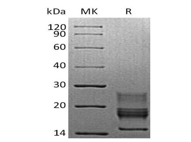 Recombinant Mouse Interferon γ/IFNG Protein (His Tag) - image 1