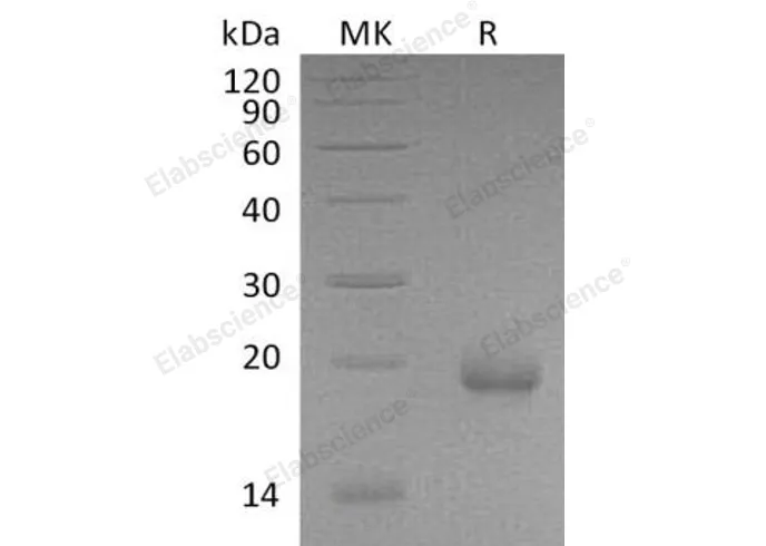 Recombinant Mouse IFN-zeta/Limitin Protein (His Tag) - image 1