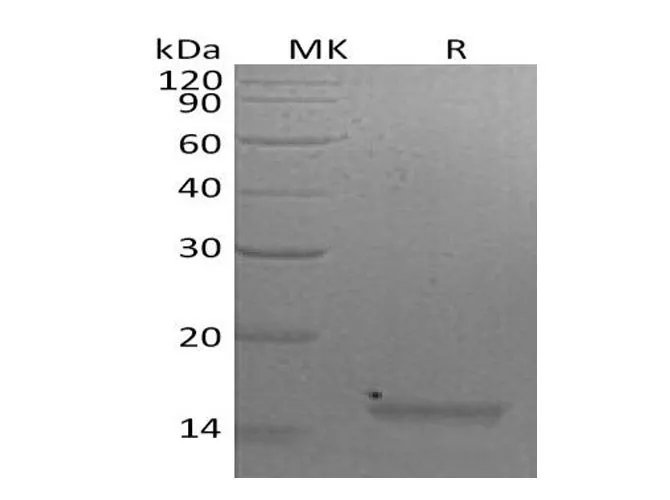 Recombinant Mouse Interleukin-21/IL-21 Protein - image 1