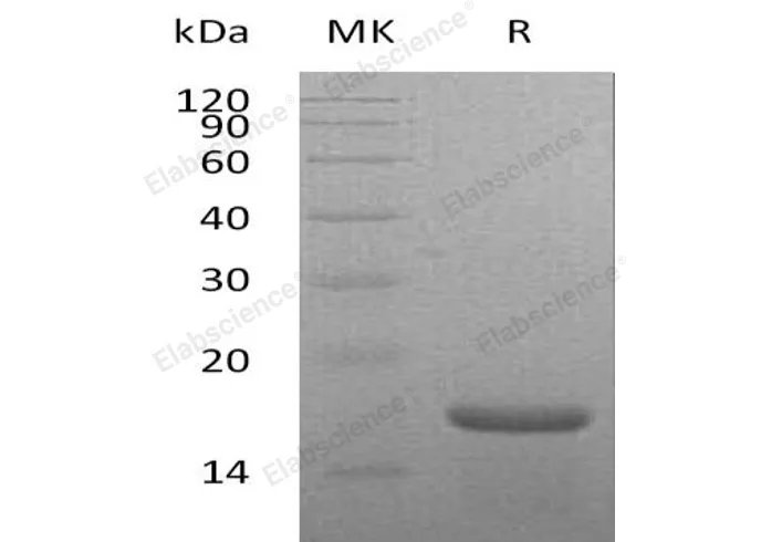 Recombinant Mouse Interleukin-21/IL-21 Protein (His Tag) - image 1