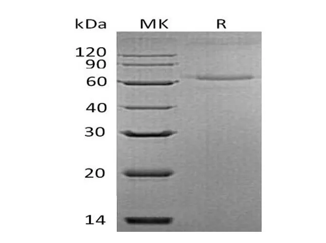 Recombinant Mouse Interleukin-27/IL-27 Protein (His Tag) - image 1