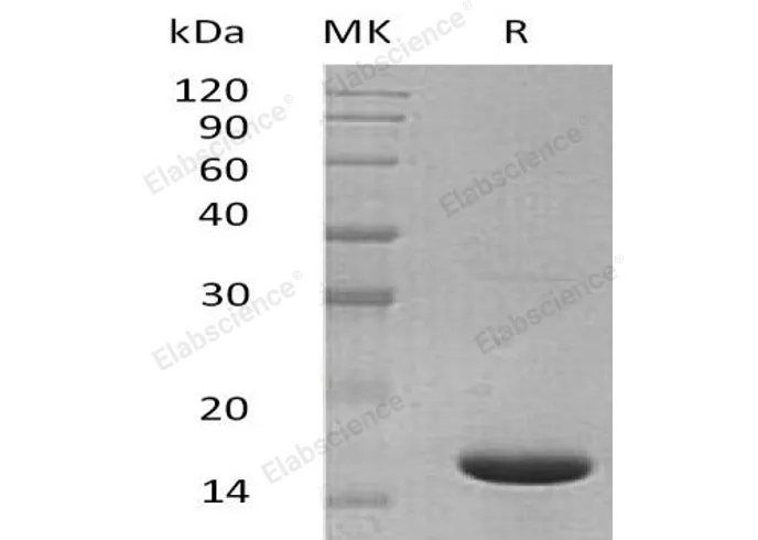 Recombinant Mouse IL1F6/IL36A Protein - image 1