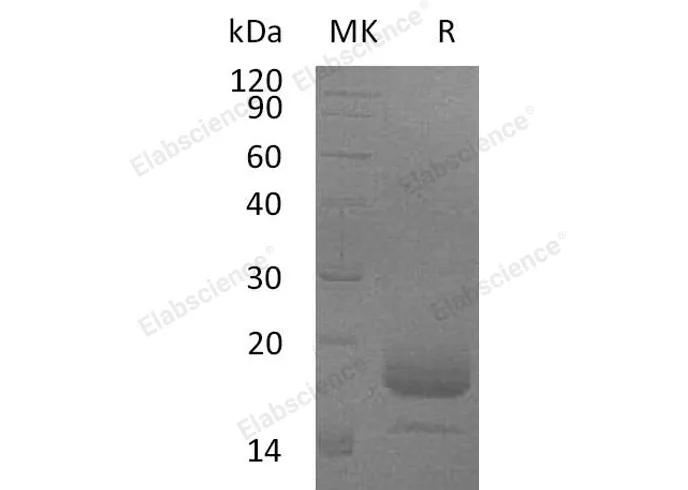 Recombinant Mouse Interleukin-4/IL-4 Protein (His Tag) - image 1
