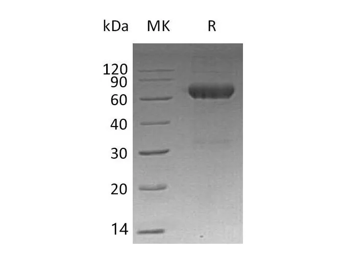 Recombinant Mouse MMP12/MMP-12/HME Protein (His Tag) - image 1