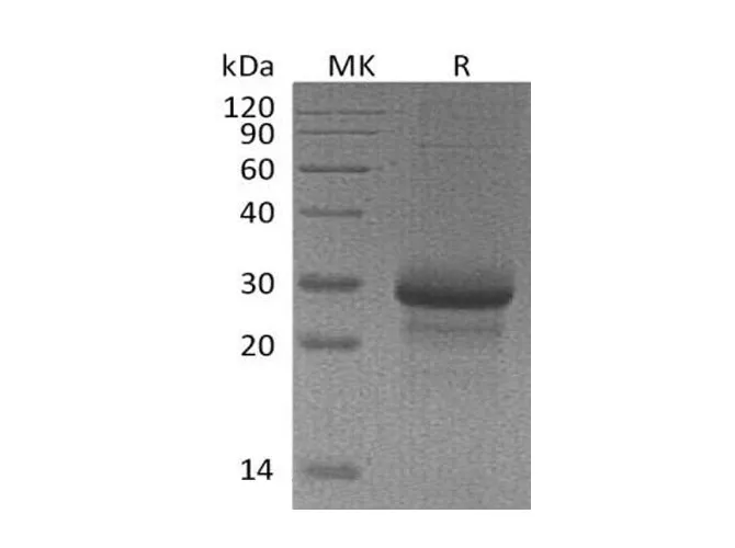 Recombinant Mouse MBL2/MBP-C Protein - image 1