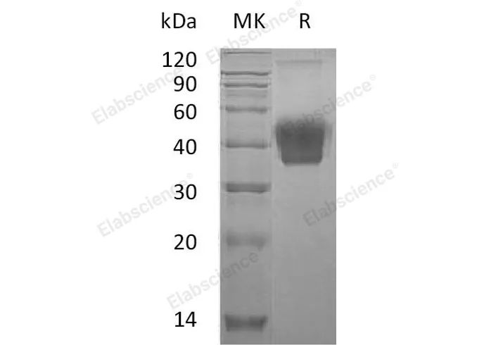 Recombinant Mouse M-CSF/CSF1 Protein (His Tag) - image 1