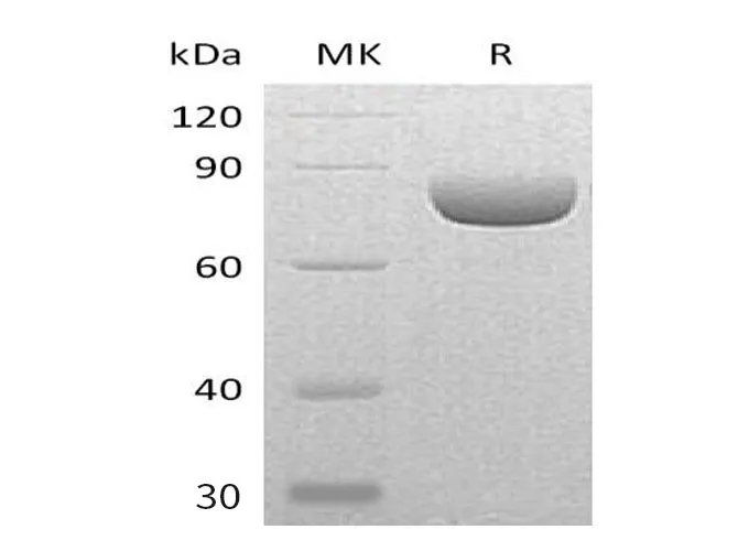 Recombinant Mouse Semaphorin-4A/SEMA4A Protein (His Tag) - image 1